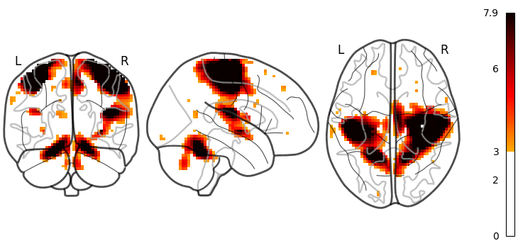 plot demo glass brain extensive