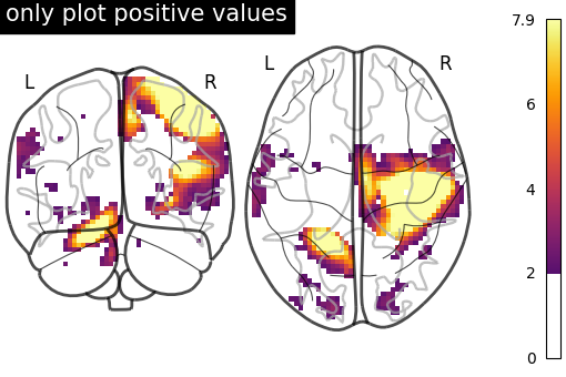 plot demo glass brain extensive