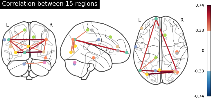 connectome