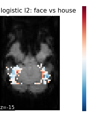 ../_images/sphx_glr_plot_haxby_different_estimators_003.png