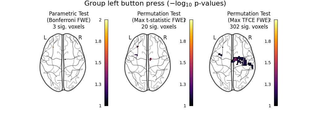 Group left button press ($-\log_{10}$ p-values), Parametric Test (Bonferroni FWE) 3 sig. voxels, Permutation Test (Max t-statistic FWE) 20 sig. voxels, Permutation Test (Max TFCE FWE) 302 sig. voxels