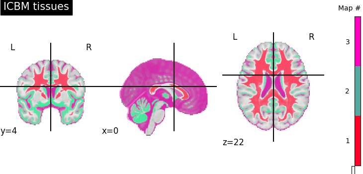 plot prob atlas