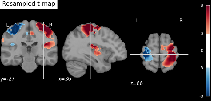../_images/sphx_glr_plot_resample_to_template_002.png