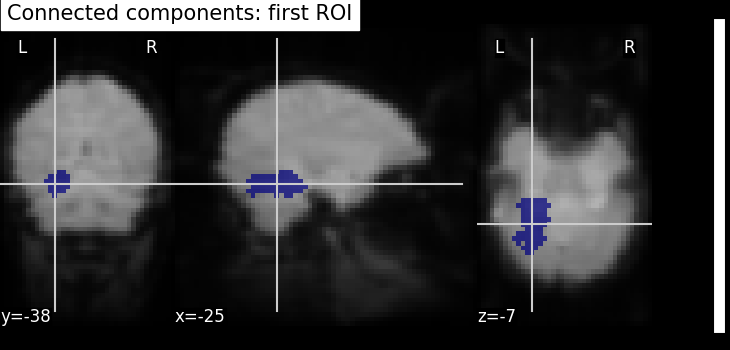 plot roi extraction