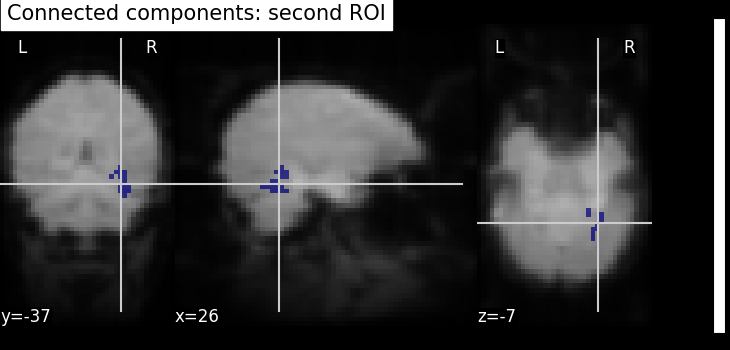 plot roi extraction