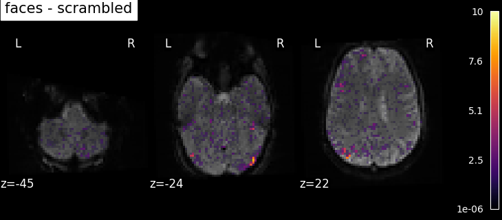 plot spm multimodal faces