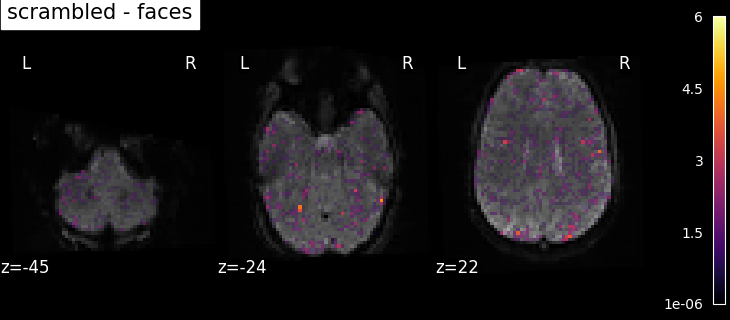 plot spm multimodal faces