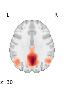 plot 3d and 4d niimg