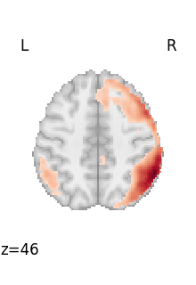 plot 3d and 4d niimg
