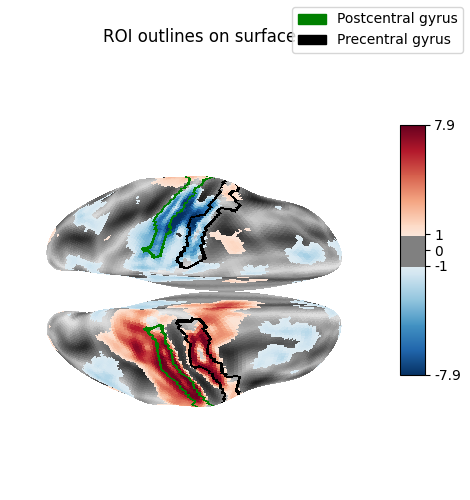 ROI outlines on surface