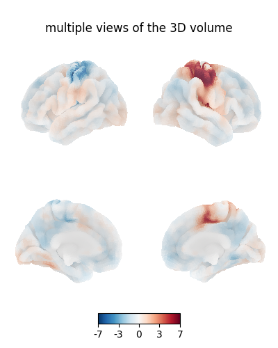 multiple views of the 3D volume