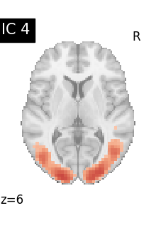 plot compare decomposition