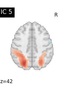 plot compare decomposition