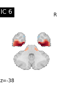 plot compare decomposition