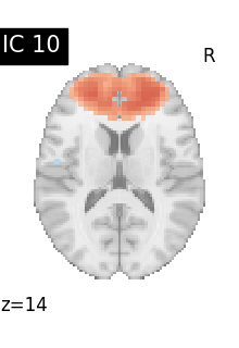 plot compare decomposition