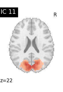 plot compare decomposition