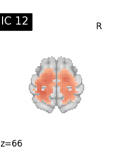 plot compare decomposition