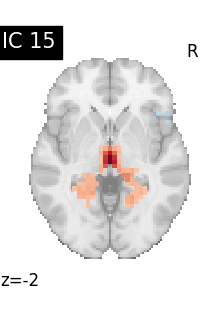 plot compare decomposition