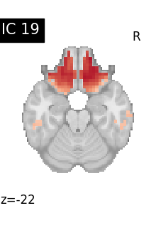 plot compare decomposition