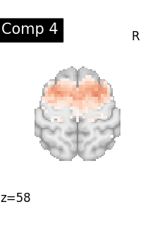 plot compare decomposition