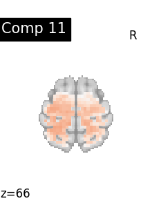 plot compare decomposition