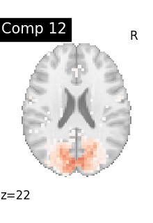plot compare decomposition