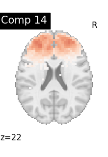 plot compare decomposition