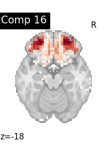 plot compare decomposition