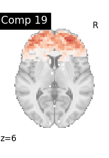 plot compare decomposition