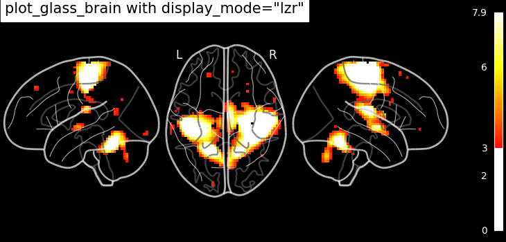 plot demo glass brain extensive