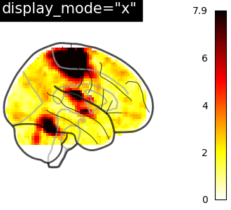 plot demo glass brain extensive