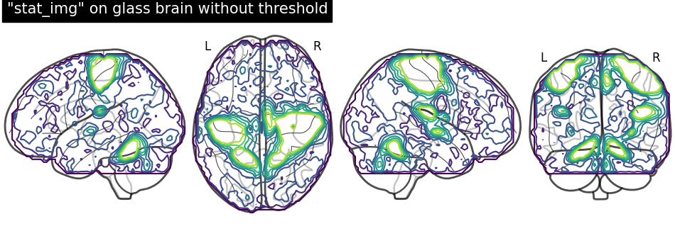 plot demo glass brain extensive
