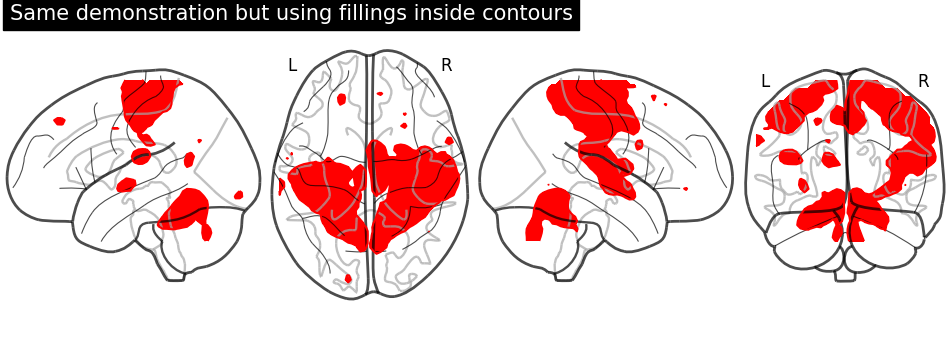 plot demo glass brain extensive