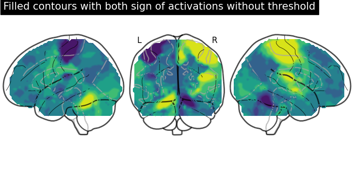 plot demo glass brain extensive