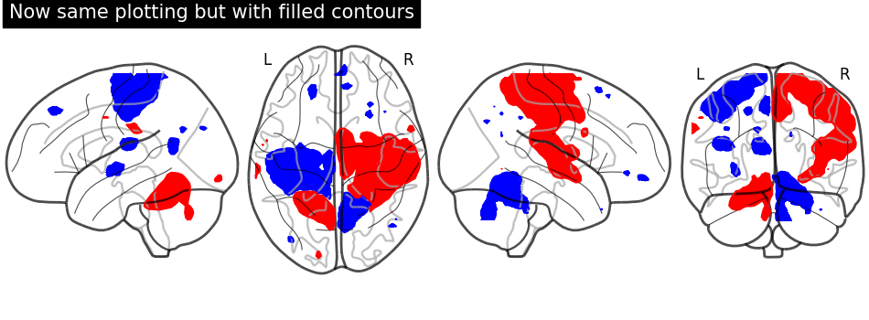plot demo glass brain extensive