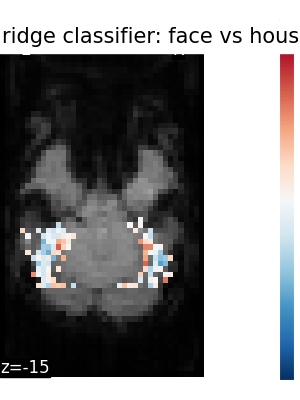../_images/sphx_glr_plot_haxby_different_estimators_004.png