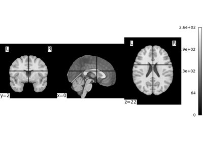 Basic nilearn example: manipulating and looking at data