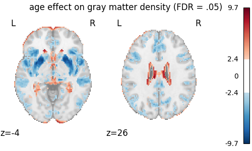 age effect on gray matter density (FDR = .05)