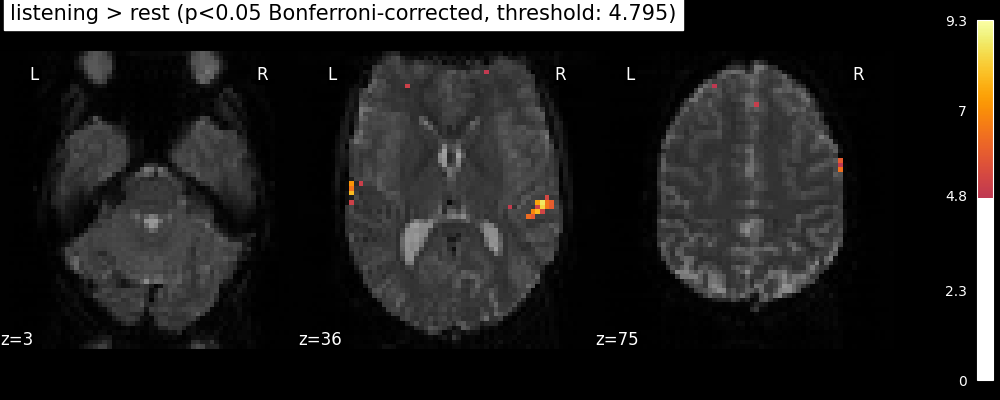 plot single subject single run