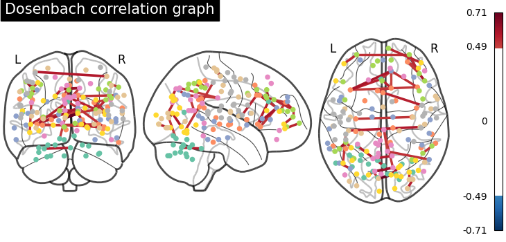 plot sphere based connectome