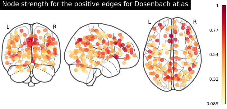 plot sphere based connectome