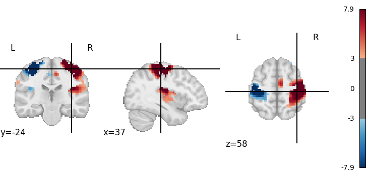 plot 3d and 4d niimg