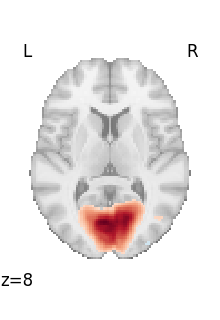 plot 3d and 4d niimg