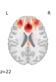 plot 3d and 4d niimg