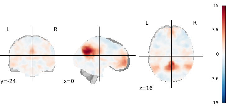 plot 3d and 4d niimg