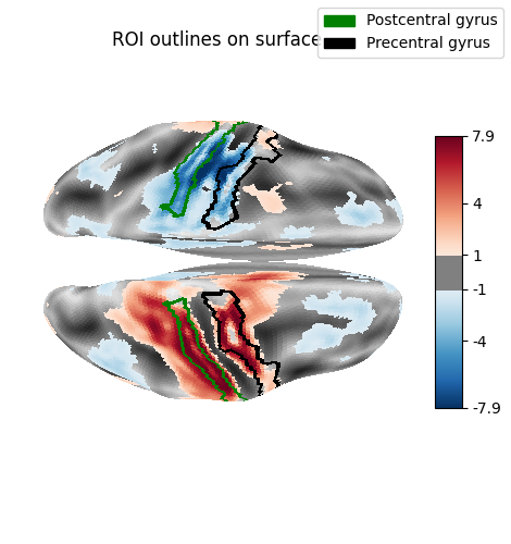 ROI outlines on surface