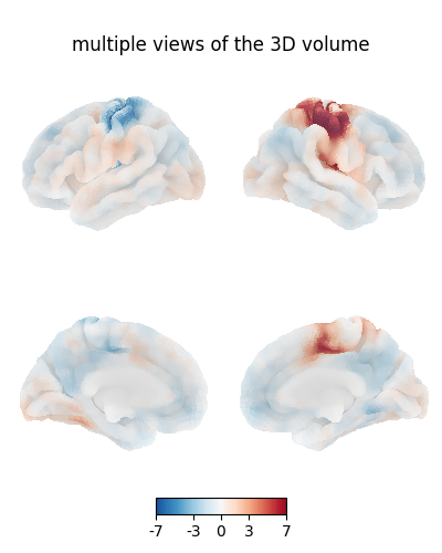 multiple views of the 3D volume