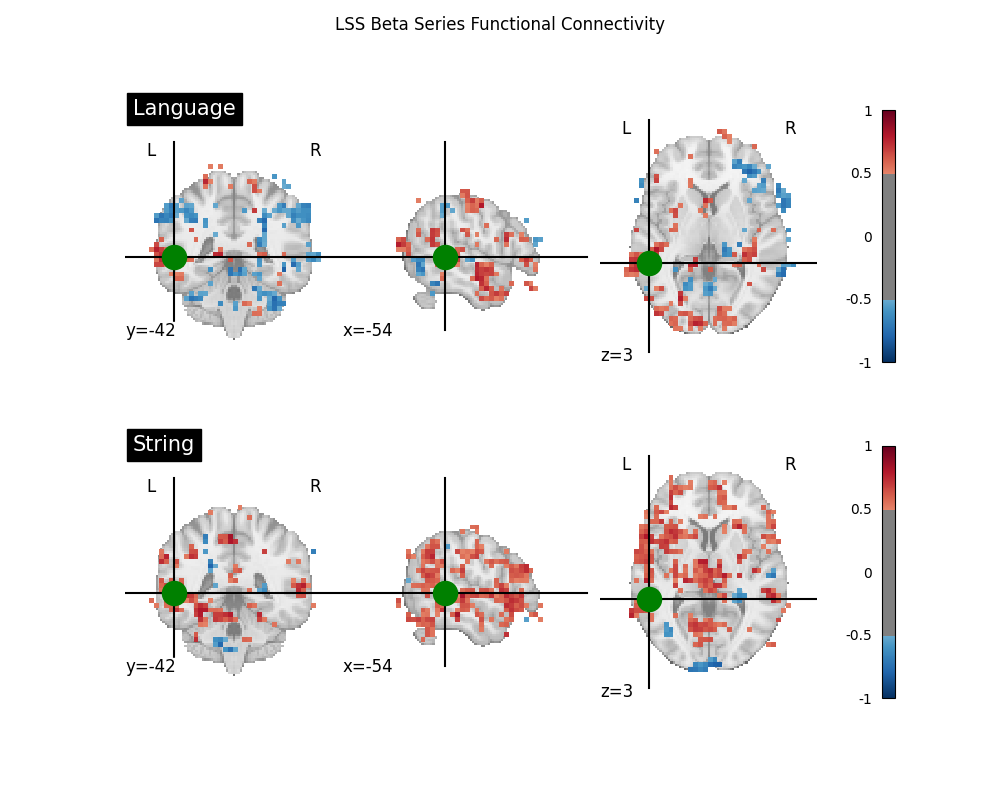 LSS Beta Series Functional Connectivity