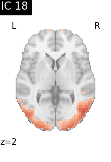 plot compare decomposition