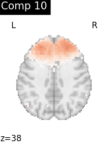 plot compare decomposition